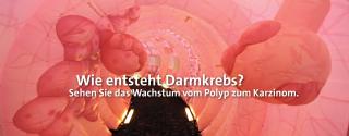 Darmmodell Wachstum